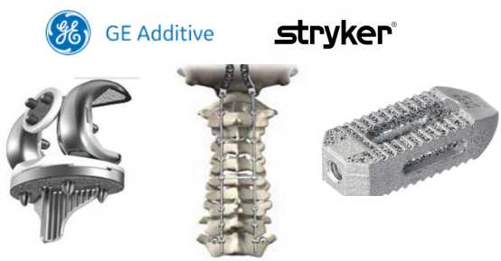 GE與醫療器械制造商Stryker結成3D打印合作伙伴關系
