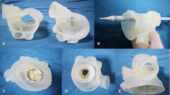 逐漸納入醫保范圍的3D打印模型，將會對醫工結合帶來哪些不同？